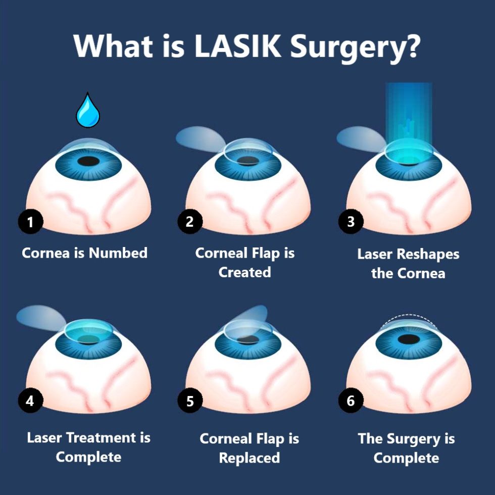 All Laser LASIK Azar Eye Clinic